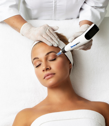 Behandling med Microneedling - Dermapen